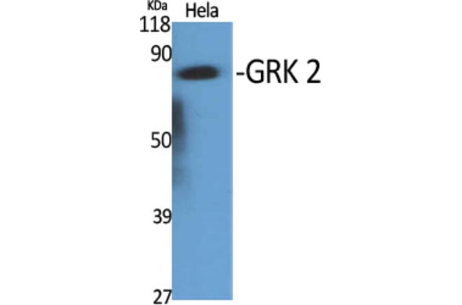 Western Blot - Anti-ARBK1 Antibody (C10475) - Antibodies.com
