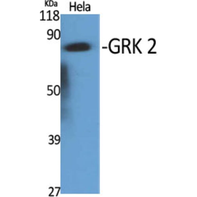 Western Blot - Anti-ARBK1 Antibody (C10475) - Antibodies.com