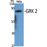 Western Blot - Anti-ARBK1 Antibody (C10475) - Antibodies.com