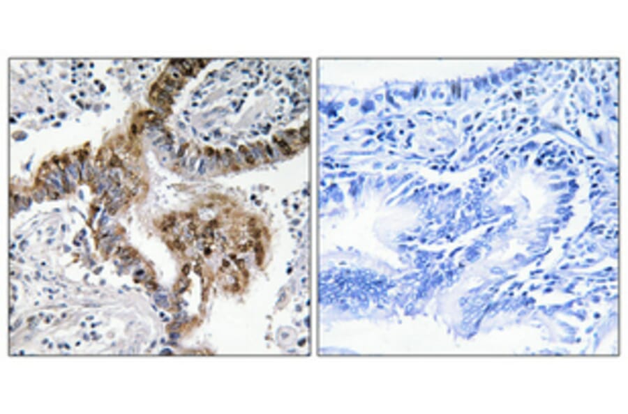 Immunohistochemistry - Anti-ARBK1 Antibody (C10475) - Antibodies.com