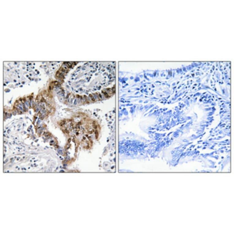 Immunohistochemistry - Anti-ARBK1 Antibody (C10475) - Antibodies.com