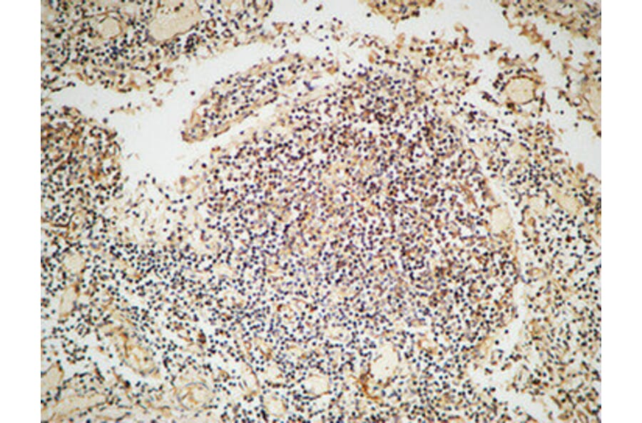 Immunohistochemistry - Anti-ARBK1 Antibody (C10475) - Antibodies.com