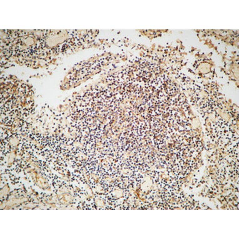 Immunohistochemistry - Anti-ARBK1 Antibody (C10475) - Antibodies.com