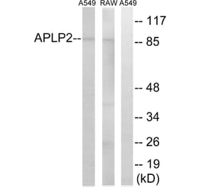 Western Blot - Anti-APLP2 Antibody (C14458) - Antibodies.com