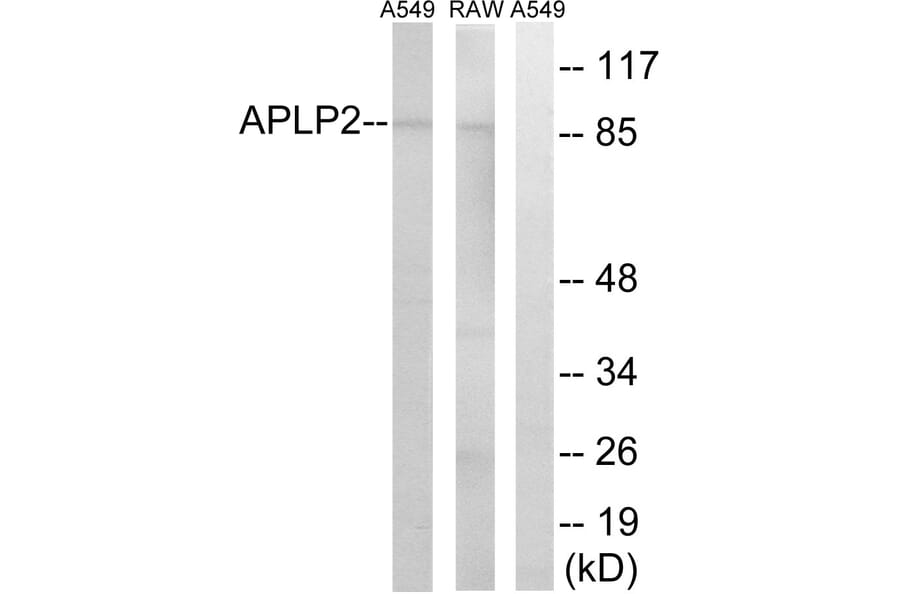 Western Blot - Anti-APLP2 Antibody (C14458) - Antibodies.com