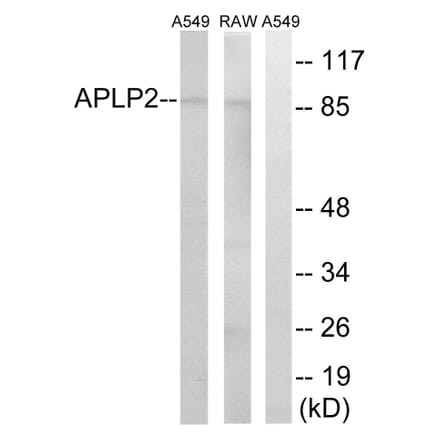 Western Blot - Anti-APLP2 Antibody (C14458) - Antibodies.com