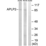 Western Blot - Anti-APLP2 Antibody (C14458) - Antibodies.com