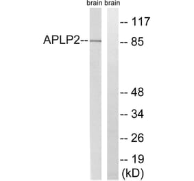 Western Blot - Anti-APLP2 Antibody (B8292) - Antibodies.com