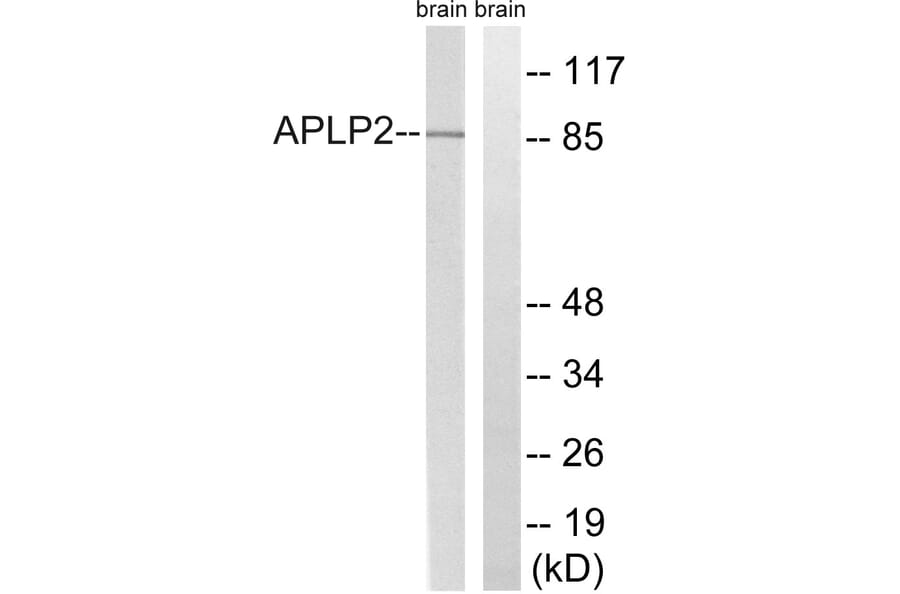 Western Blot - Anti-APLP2 Antibody (B8292) - Antibodies.com