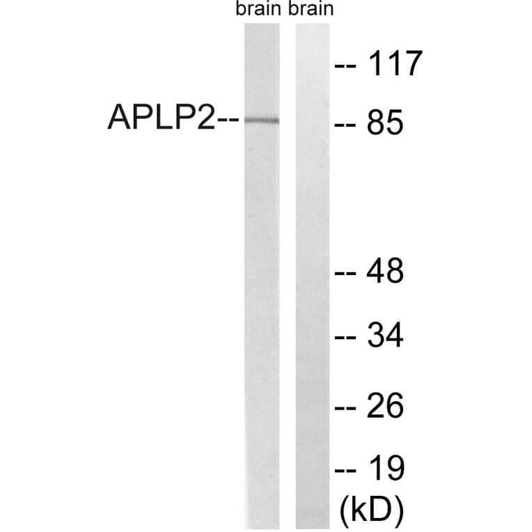 Western Blot - Anti-APLP2 Antibody (B8292) - Antibodies.com