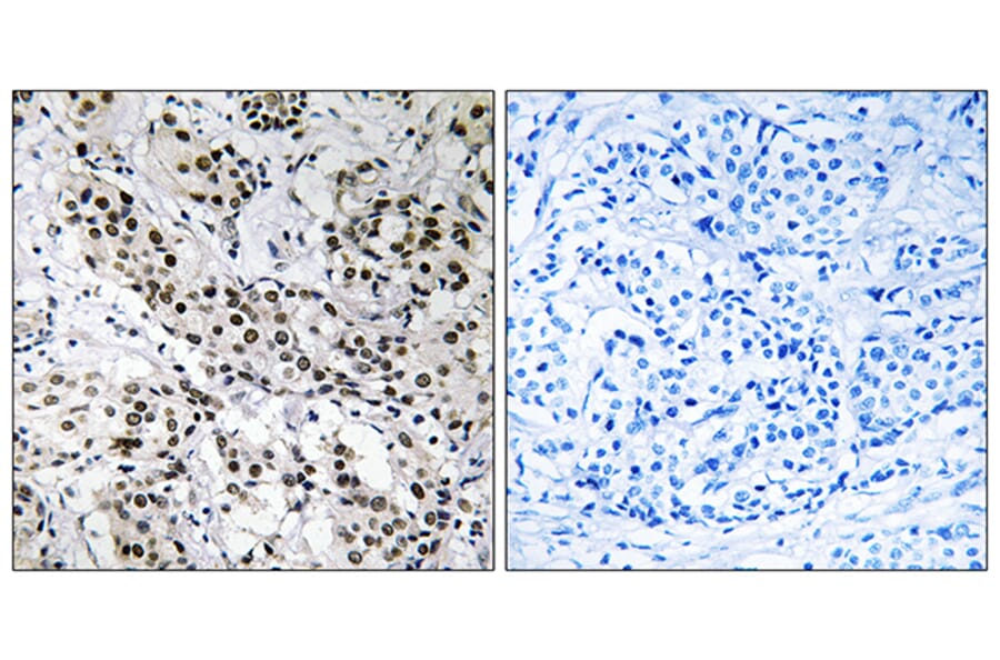 Immunohistochemistry - Anti-APBB2 Antibody (C14453) - Antibodies.com