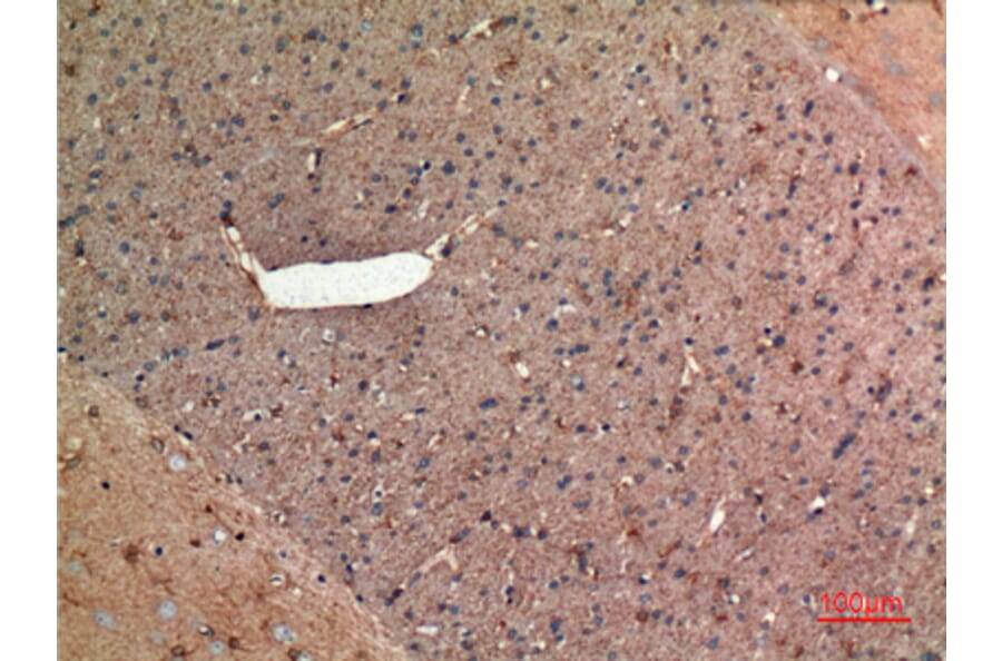 Immunohistochemistry - Anti-ALDOC Antibody (C30108) - Antibodies.com