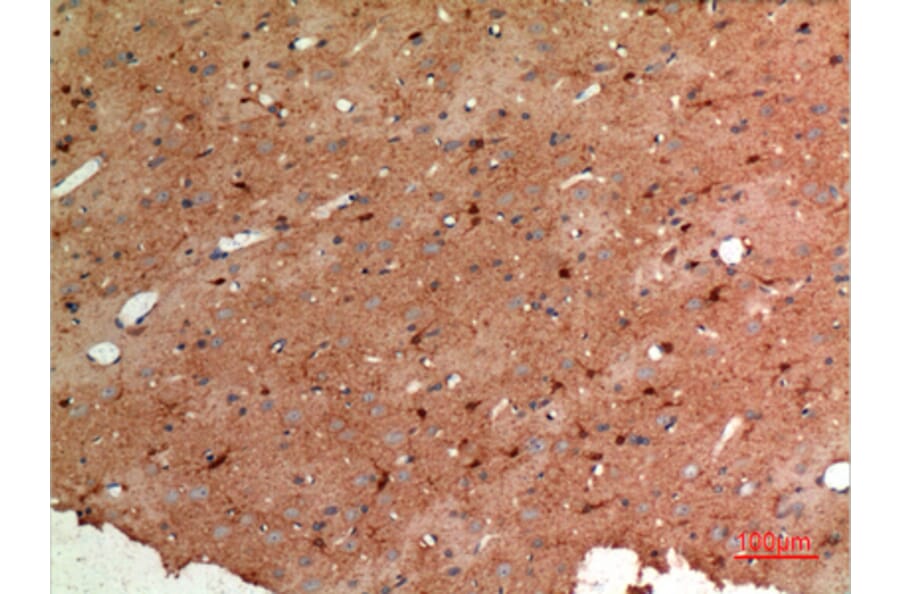 Immunohistochemistry - Anti-ALDOC Antibody (C30108) - Antibodies.com
