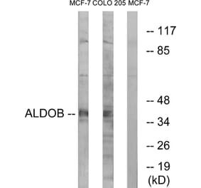 Western Blot - Anti-ALDOB Antibody (C15822) - Antibodies.com