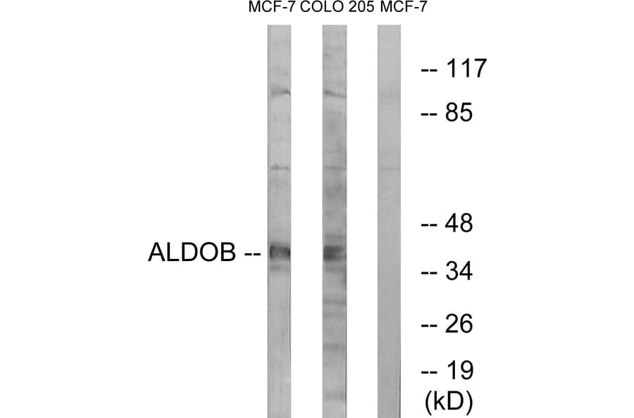 Western Blot - Anti-ALDOB Antibody (C15822) - Antibodies.com