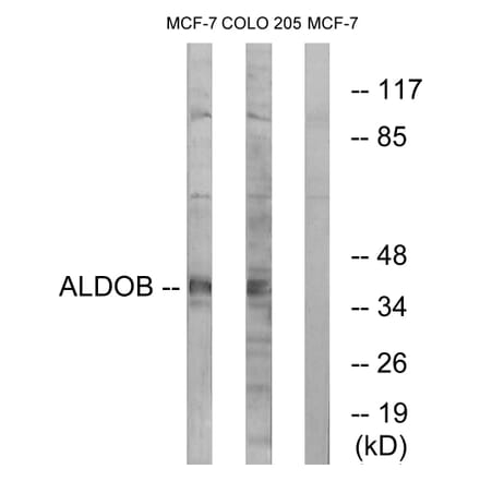 Western Blot - Anti-ALDOB Antibody (C15822) - Antibodies.com