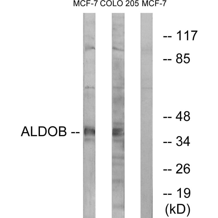 Western Blot - Anti-ALDOB Antibody (C15822) - Antibodies.com