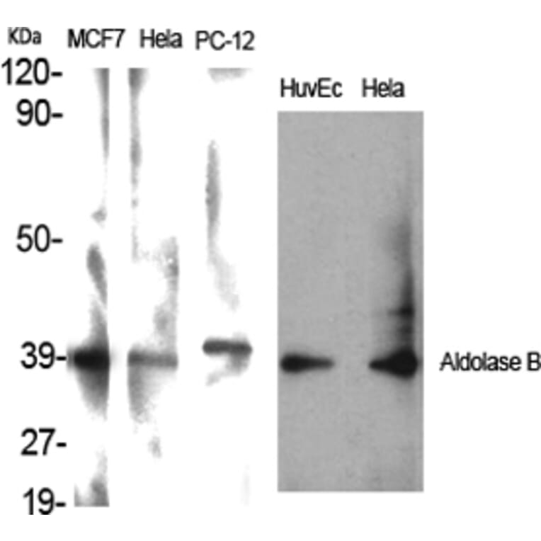 Western Blot - Anti-ALDOB Antibody (C15822) - Antibodies.com