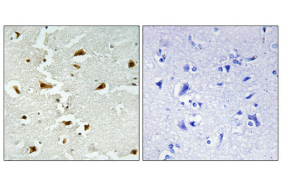 Immunohistochemistry - Anti-ALDOB Antibody (C15822) - Antibodies.com