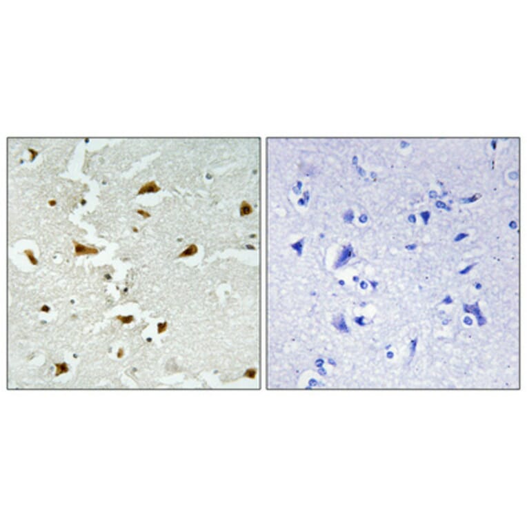 Immunohistochemistry - Anti-ALDOB Antibody (C15822) - Antibodies.com