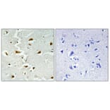 Immunohistochemistry - Anti-ALDOB Antibody (C15822) - Antibodies.com
