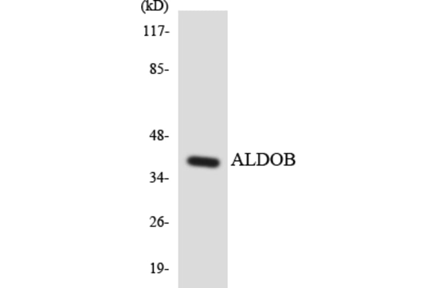 Western Blot - Anti-ALDOB Antibody (R12-2477) - Antibodies.com