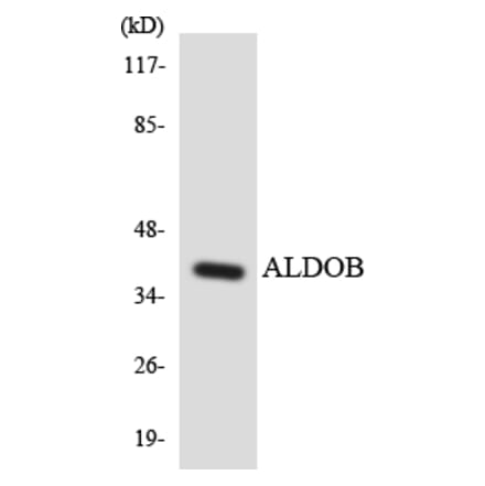 Western Blot - Anti-ALDOB Antibody (R12-2477) - Antibodies.com