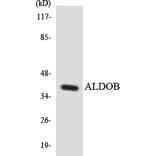 Western Blot - Anti-ALDOB Antibody (R12-2477) - Antibodies.com