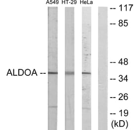 Western Blot - Anti-ALDOA Antibody (C10268) - Antibodies.com