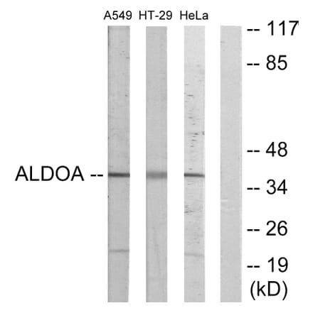 Western Blot - Anti-ALDOA Antibody (C10268) - Antibodies.com