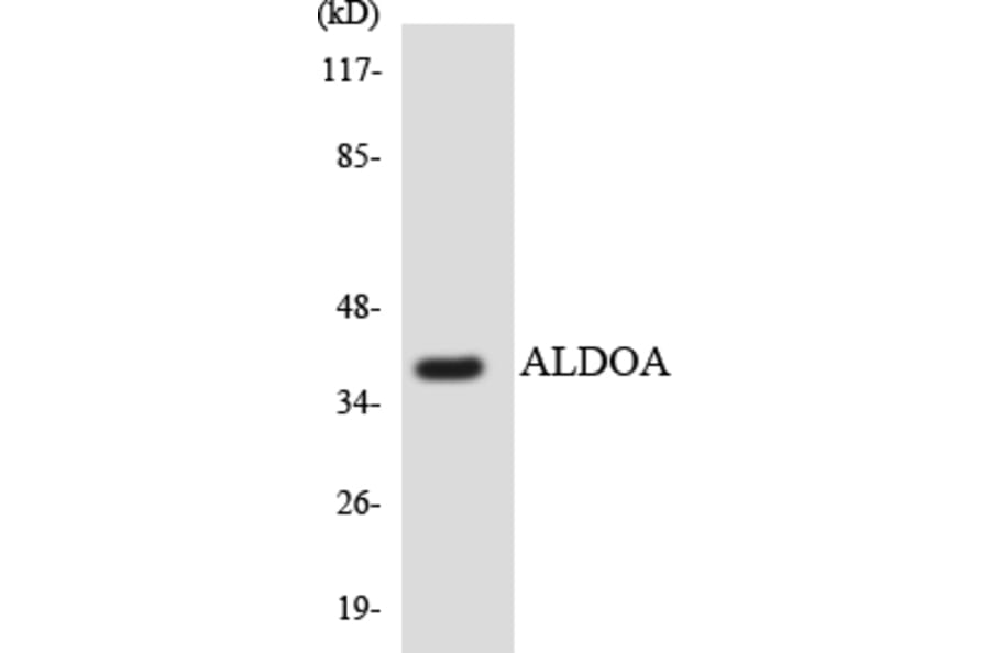 Western Blot - Anti-ALDOA Antibody (R12-2476) - Antibodies.com