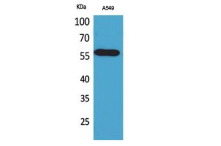 Western Blot - Anti-ALDH2 Antibody (C30032) - Antibodies.com
