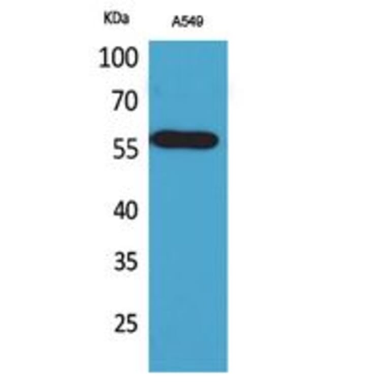 Western Blot - Anti-ALDH2 Antibody (C30032) - Antibodies.com