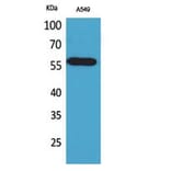 Western Blot - Anti-ALDH2 Antibody (C30032) - Antibodies.com