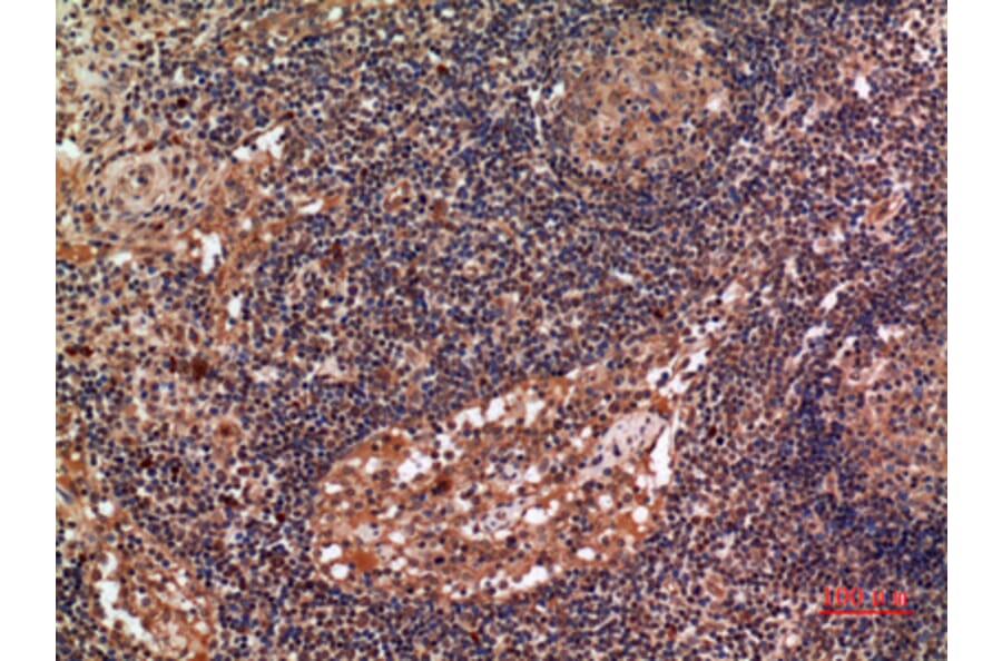 Immunohistochemistry - Anti-ALDH2 Antibody (C30032) - Antibodies.com