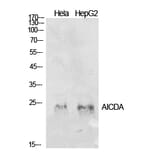 Western Blot - Anti-AICDA Antibody (C30200) - Antibodies.com