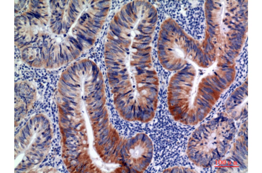 Immunohistochemistry - Anti-AICDA Antibody (C30200) - Antibodies.com