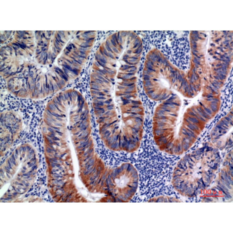 Immunohistochemistry - Anti-AICDA Antibody (C30200) - Antibodies.com
