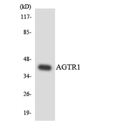 Western Blot - Anti-AGTR1 Antibody (R12-2463) - Antibodies.com