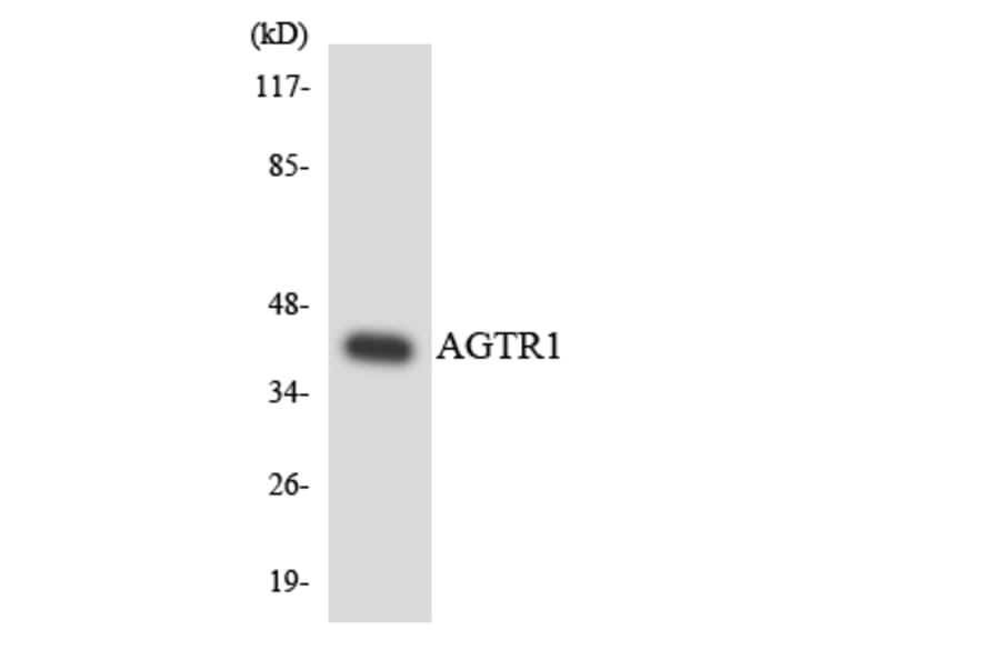 Western Blot - Anti-AGTR1 Antibody (R12-2463) - Antibodies.com