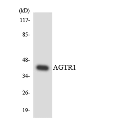 Western Blot - Anti-AGTR1 Antibody (R12-2463) - Antibodies.com