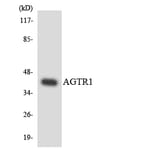 Western Blot - Anti-AGTR1 Antibody (R12-2463) - Antibodies.com
