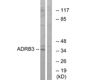 Western Blot - Anti-ADRB3 Antibody (G033) - Antibodies.com