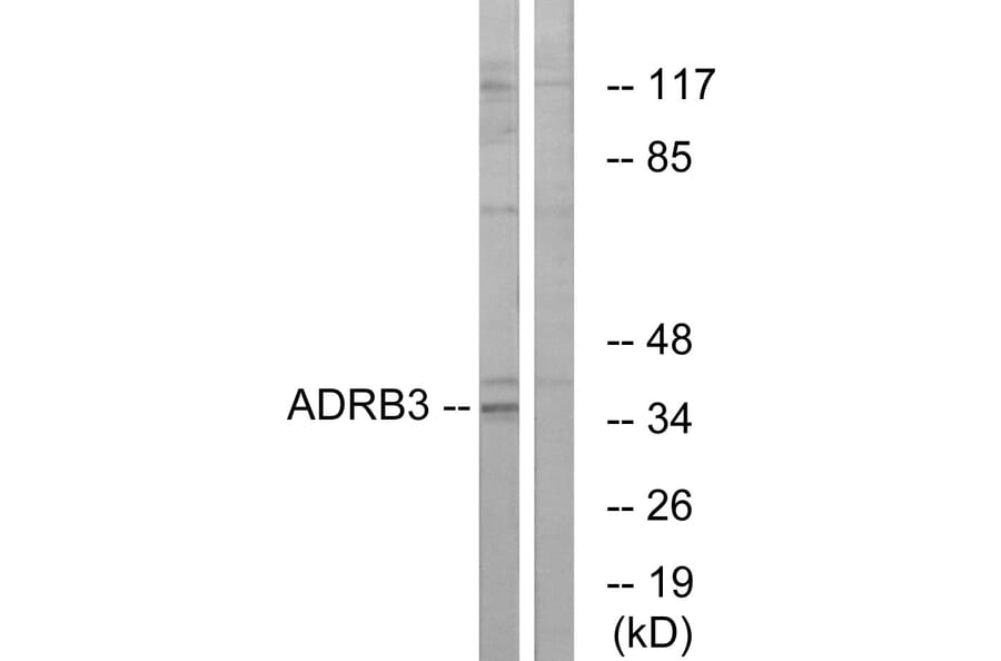 Western Blot - Anti-ADRB3 Antibody (G033) - Antibodies.com