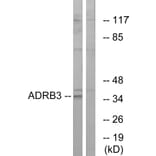 Western Blot - Anti-ADRB3 Antibody (G033) - Antibodies.com
