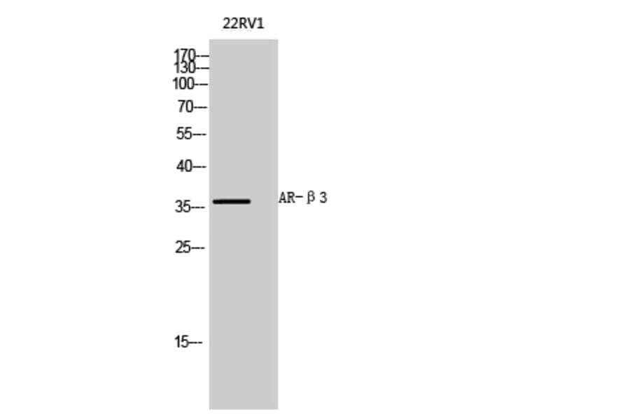 Western Blot - Anti-ADRB3 Antibody (G033) - Antibodies.com