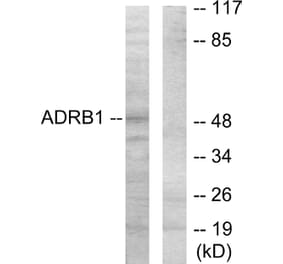 Western Blot - Anti-ADRB1 Antibody (C12043) - Antibodies.com