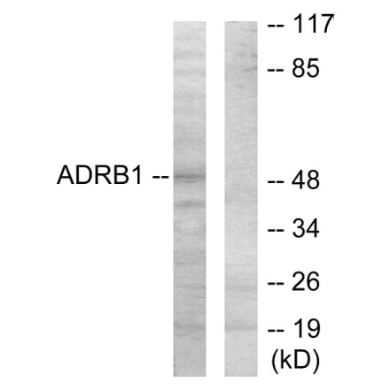 Western Blot - Anti-ADRB1 Antibody (C12043) - Antibodies.com