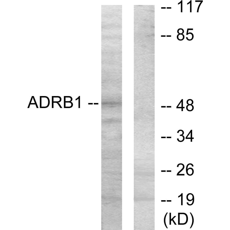 Western Blot - Anti-ADRB1 Antibody (C12043) - Antibodies.com