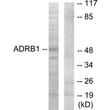 Western Blot - Anti-ADRB1 Antibody (C12043) - Antibodies.com